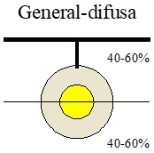 Tipos de luminarias: Imagen de una luminaria general-difusa