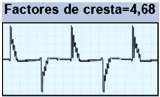 Imagen factor de cresta 4.68
